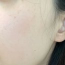 선샤인피부과의원 이미지