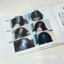 이안두피탈모 이미지