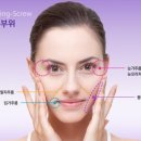 이오V 이미지
