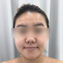 울산윤곽관리 수분도 채워진 에스테티아 울산대점