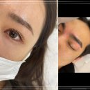 올케어 강남 이미지