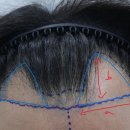 연세모에버의원 이미지