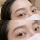 부천제일연합의원 | 부천 중동 눈썹문신 20년 경력을 만나니 달라진 후기