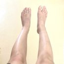 손유나클리닉 종아리캣 지방분해주사 꾸준하게 받은 최종후기