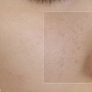 태양약국 | 약국 도미나 기미크림 사용법 바르는 순서 부작용 없이 효과 높이려면