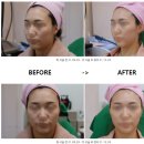 비스포크의원 이미지