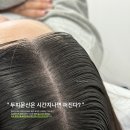 [구미 두피문신 더한결] '정수리 커버 4회차 후기' - 구미 광평동 두피문신