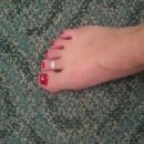 Metatarsal Arcing or Doming Foot Intrinsic Muscle Strengthening 이미지