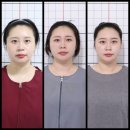 다빈치한의원 | 안면비대칭교정 한의원 얼굴비대칭 치료 32회차 후기