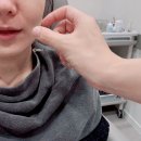 광주 온다리프팅 이중턱 팔자주름 후기