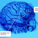 베르니케 이미지