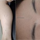 20235545 송유진 의안과제(2) 이미지
