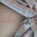 NR-6[양수로]-하-2 | 대구 효성병원 초산모 자연분만 후기 (양수파열, 유도분만, 흡입분만)