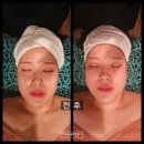 [인천 청라] 청라 피부관리 더스파엣오아시스에서 림프부종관리 받았어요