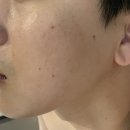 충주 연수동 남자 피부관리 추천 고고스킨