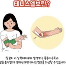 나스정형외과의원 네이버블로그