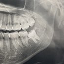 융구강악안면외과치과의원 이미지