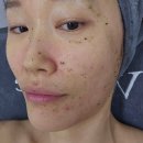 대맥프라자 | 부천에스테틱 / 부천웨딩관리 :: 위라인 환생필 피부관리 후기