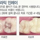 덴포유 이미지