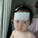 신도시이진병원 | 신도시이진 특실 3박4일 입원후기( 9개월 아기 파라바이러스 후두염)