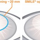 스마일 Smile 이미지