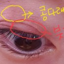 안동삼성연합안과