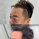 노스탈