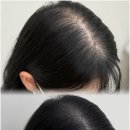 스테이 무아 이미지