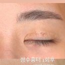 콜드 플라 송파 이미지