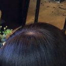 원스칼프 | 부산 전포동 두피케어 후기 원스칼프 부산본점