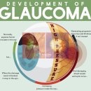 청주퍼스트안과의원 이미지