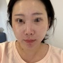 [뷰티후기] 침산동 토탈뷰티샵 &#39;고아라뷰티&#39; 피부관리 대만족후기