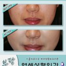 연세성형외과 이미지