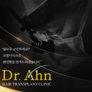 닥터안헤어플란트의원 | 탈모 고민 해결! 닥터안 헤어트랜스플란트의원에서 만나는 맞춤형 모발이식