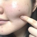 엘림케어 | [생활용품] 민감성 트러블 피부 케어에 딱! ‘오르엘림 노니 수제 천연 비누‘ 사용 후기