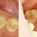 아이엠치과기공소 이미지