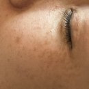 피부사랑 스킨케어 | 마곡에스테틱 문제성피부 전문 라인메이드 스킨케어 후기