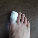 한빛정형외과 티스토리