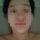 금이야옥이야피부관리