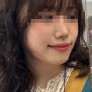 생활도자기(고급) | 순천 조례동 피부과에서 도자기피부결레이저 당일후기