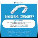연세엔서울치과교정과치과의원 | 서대문치과 치아교정을 투명하게
