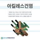 춘천우리마취통증의학과의원 네이버블로그
