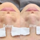 비에이치씨(BHC)연산반도보라 | 연산동 모공관리 파메스테틱 세멘시트 최고! 연산 리제이에스테틱