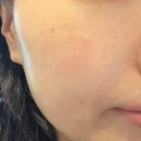 오룸스킨 이미지