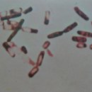 Bacillus subtilis 이미지