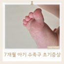 아이퍼스트아동병원 | 7개월 아기 수족구 초기증상 39도 고열로 아이퍼스트 아동병원 다녀온 후기