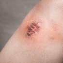 비바덤의원 이미지