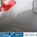 덴트존 이미지