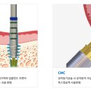이노바이오써지 이미지