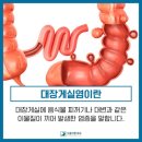 대장게실염으로 응급실👉5일 금식 후기(병원비 포함) 이미지